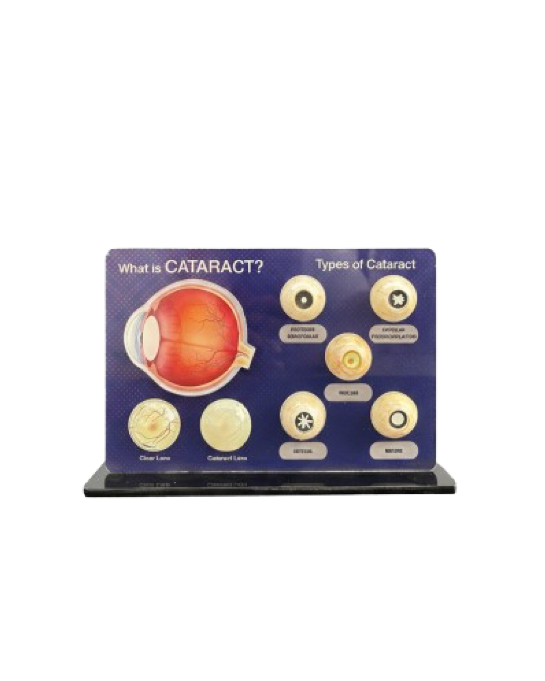 Cataract_Counselling_Tool