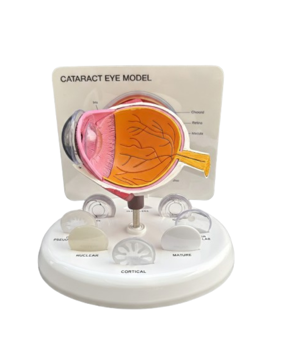 Cataract_Eye_Model_1