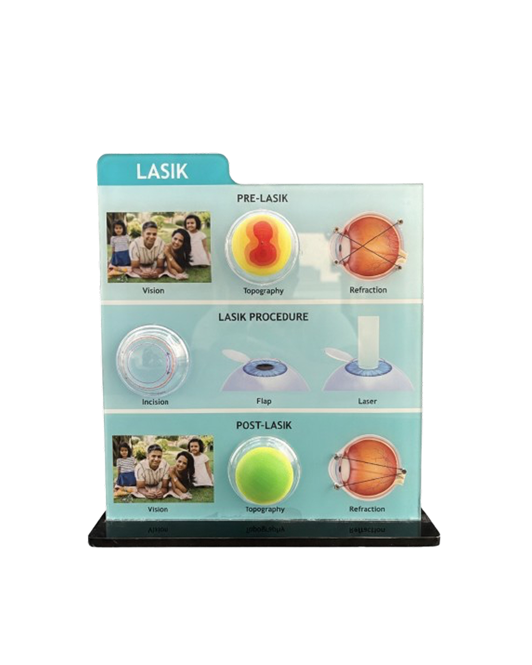 Lasik_Counselling_Tool