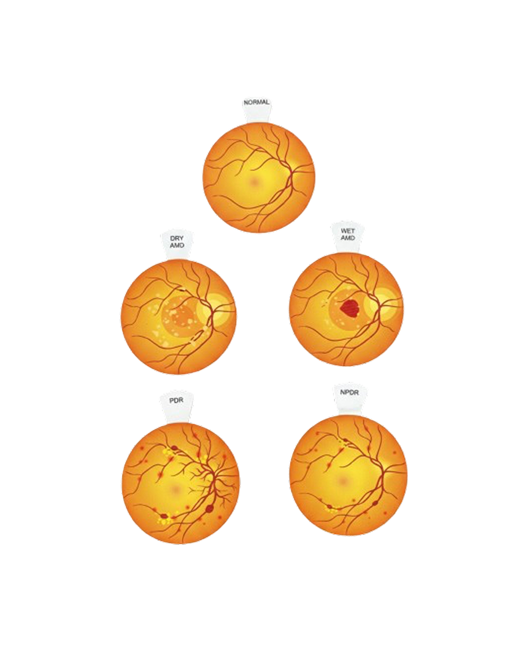 New_Retinal_Eye_Model_3