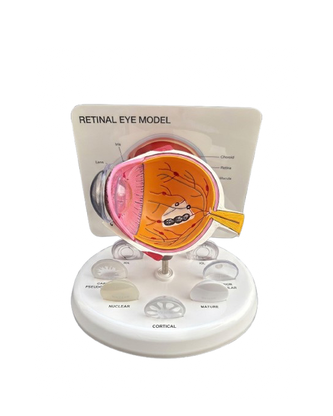 Retinal_Disease_Eye_Model